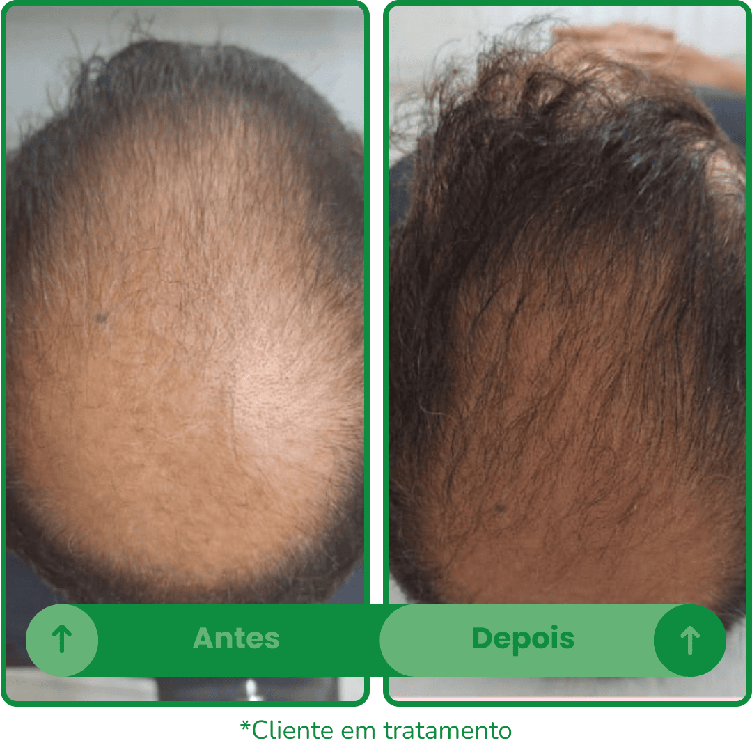 Antes e depois 1